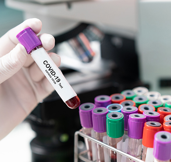 Corona blodprøve tiltak i bedrifter mot coronasmitte